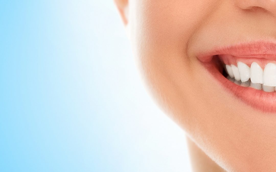 Understanding 100% Santé for teeth